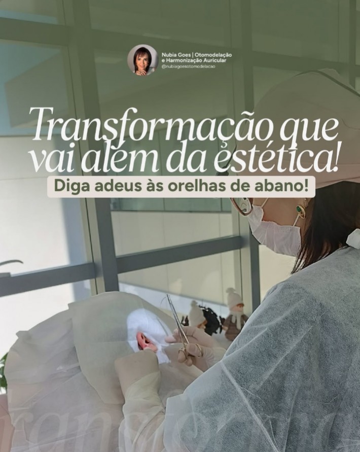 Postagem de Nubia Goes – Estética de Orelhas e Otomodelação