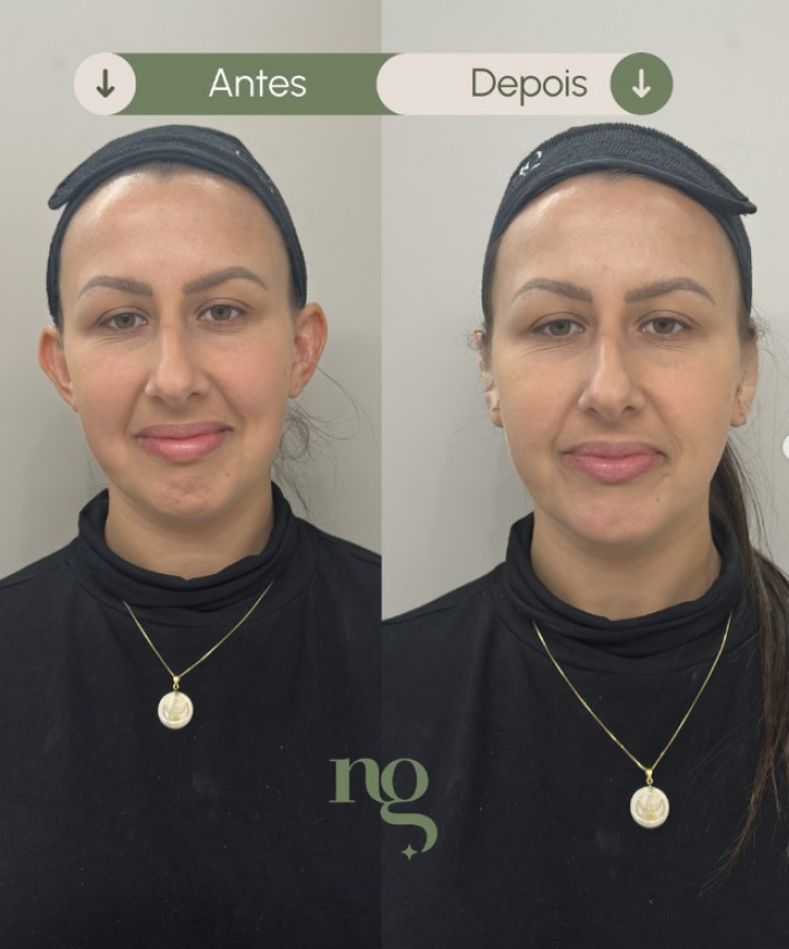 Postagem de Nubia Goes – Estética de Orelhas e Otomodelação