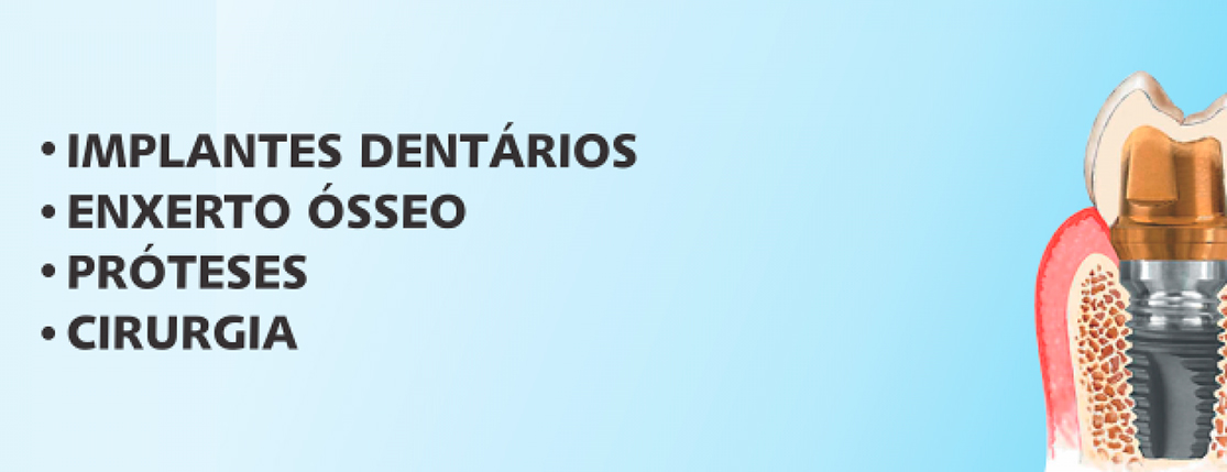 Banner Dr. Fabrício Vogt – Cirurgião Dentista